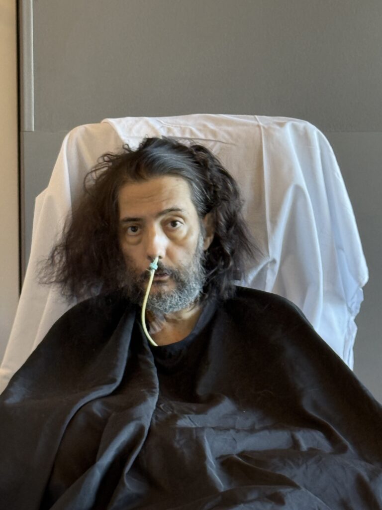 Nathaniel, with long brown hair, a long mostly-grey beard, and a Dobhoff gastric tube sticking out of his nose (taped in with skin-colored tape). He's also wearing a black haircutter's cape. He's sitting in a hospital recliner draped with a white sheet. 